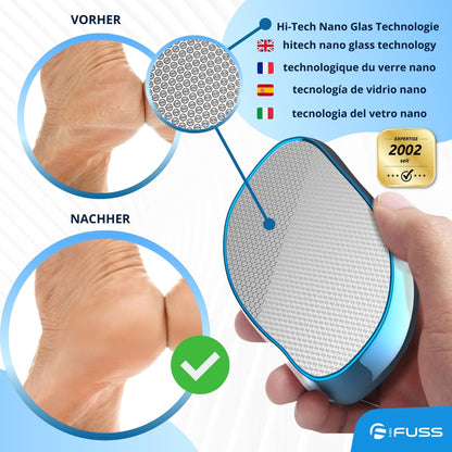 Mr. Fuss® - Nano Glass - 2 in 1 Dead Skin Remover File